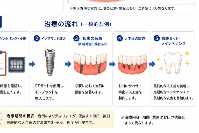 フルアーチインプラント適応症
