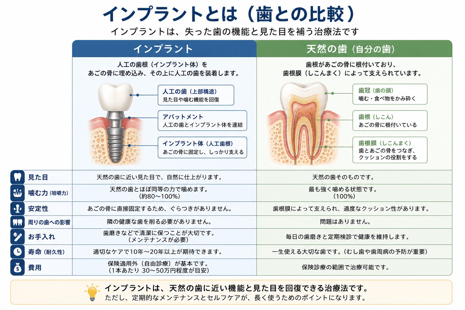 インプラントと天然の歯の構造比較図｜高山歯科室