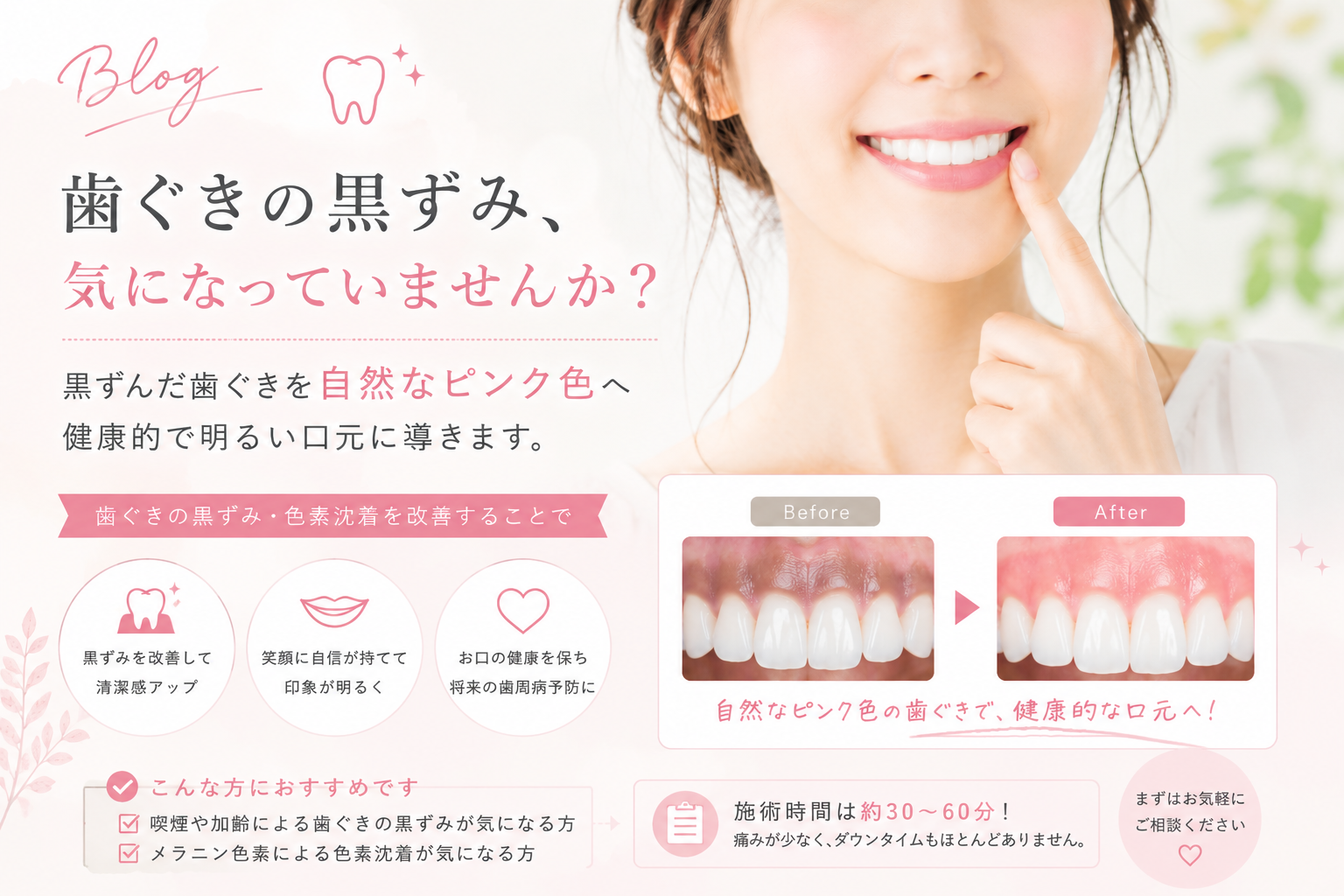 歯ぐきの黒ずみが気になる方へ｜歯ぐきの黒ずみ除去のビフォーアフター｜名古屋市中区栄 高山歯科室